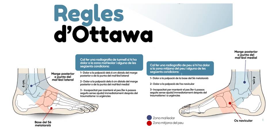 Infografia sobre les regles d’Ottawa Imatge destacada
